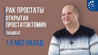 Рак простаты. Операция - простатэктомия 1,5 месяца назад