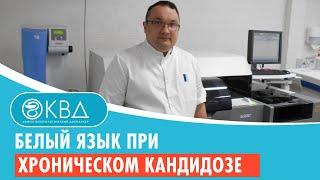  Белый язык при хроническом кандидозе. Клинический случай №864