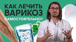 Варикоз! Основные ошибки и реальные способы самолечения варикоза!