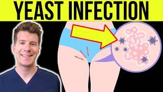 Doctor explains YEAST INFECTION (CANDIDA/THRUSH) in men and women | Causes, Symptoms, Treatment