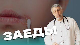 Заеды