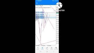 $5 To $1,000,000 Vix 75 Scalping Strategy || volatility index 75 trading killer strategy #vix