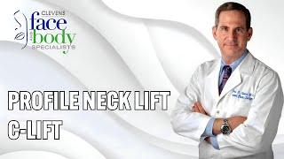 PROFILE NECK LIFT & C-LIFT | Clevens Face & Body Specialists