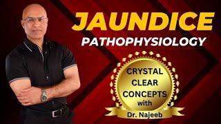 Pathophysiology Of Jaundice | Dr Najeeb Lectures