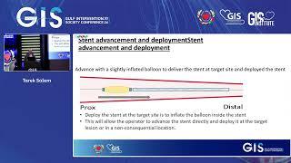 Tarek Salem - Case 7  Stent Loss