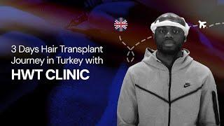 3 Days Hair Transplant Journey in Turkey with HWT CLINIC