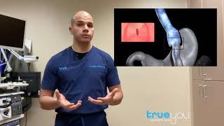 Endoscopic Gastric Bypass revision (Transoral Gastric Outlet Reduction): How does it work?