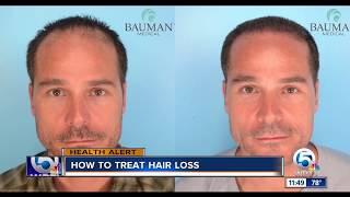 SmartGraft FUE Hair Transplant Results on NBC - Dr. Alan Bauman