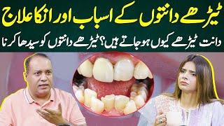 Causes and Treatment of Crooked Teeth? | Ayesha Nasir