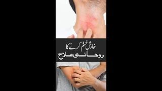 Kharish Ka Rohani ilaj | Best Wazifa For Itchy Skin Treatment | Quranic Dua For Skin Allergy | Urdu