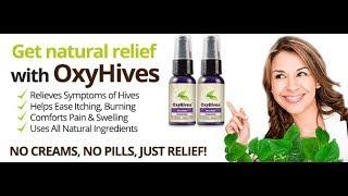 DrJack Allergy - Effective Treatment of Hives/Welts (Urticaria) - Part 2 - DrJack Allergy