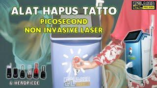 Tutorial Picosecond Non Invasive EL Laser Pro 2000 | Alat Hapus Tatto