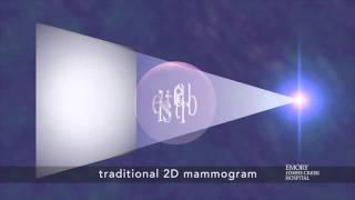 Tomosynthesis / 3-D Mammogram a New Breast Imaging Technique