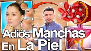 ACLARA TU PIEL AHORA - Cómo Eliminar Las Manchas Oscuras, Las Manchas De La Piel Para Siempre