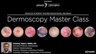 Dermoscopy Master Class