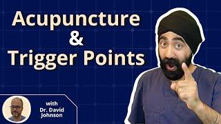 2 Important Uses of Acupuncture and Trigger Points - Gag Reflex and TMJ Pain