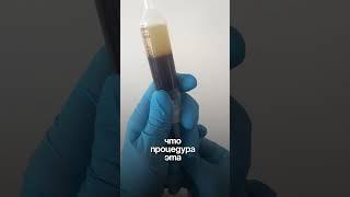 Prp-терапия #уролог #urology #медсовет #prptherapy