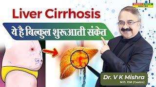 LIVER CIRRHOSIS ये है बिल्कुल शुरुआती संकेत || CIRRHOSIS OF LIVER