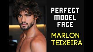 What makes Marlon Teixeira's FACE perfect?