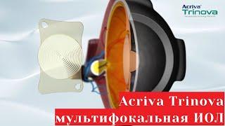 Acriva Trinova - мультифокальная синусоидальная ИОЛ. Проморолик от производителя