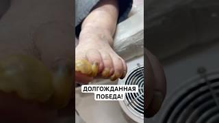 Незаметный помощник для здоровья ногтей и кожи. Забудьте про дискомфорт