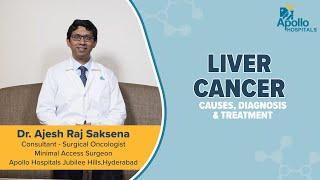 Apollo Hospitals | Liver cancer | Dr. Ajesh Raj Saksena