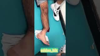 أخطر إصابة في تاريخ كرة القدم!! #كرة_القدم #معلومات #video #قصص #viral #سون #غوميز