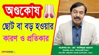 অণ্ডকোষ ছোট বা বড় হওয়ার কারণ ও প্রতিকার ।। Causes and remedies for small or large testicles