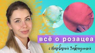 Все о Розацеа (Rosacea) - Доказательная медицина