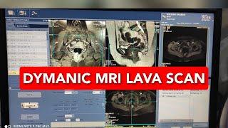 Dynamic MRI LAVA Scan | English Subtitles