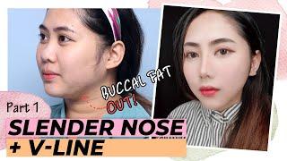 [SUB] BEAUTY TRANSFORMATION VLOG | RHINOPLASTY WITH FACIAL LIPOSUCTION SURGERY | BEFORE & AFTER VLOG