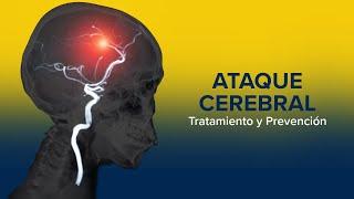 Tratamiento y prevención de un ataque cerebral (ictus)