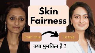 Kya fairness creams kaam karte hai | Fairness cream  | Tvacha ke doctor