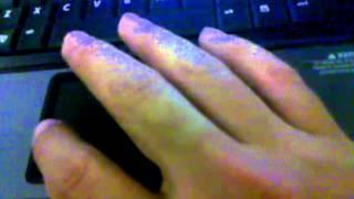 Finger twitch