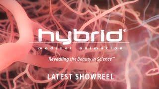 hybrid medical animation | latest showreel | #medicalanimation #showreel #demoreel #medicalvideos