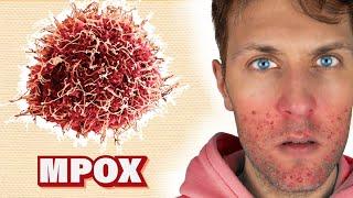 Why this Mpox Outbreak is so Different..