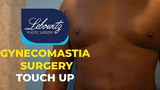 Gynecomastia Surgery: Vaser Liposculpture Touch Up & Fat Grafting | Dr. Lebowitz