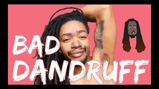 #Dandruff in My Dreadlocks - March 2019 Update