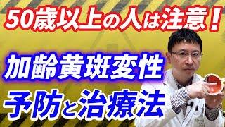 日本で失明原因４位！加齢黄斑変性の予防と治療。50歳以上の人は要注意。