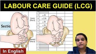 WHO- Labour Care Guide | LCG Guidelines | English | Nursing Lecture