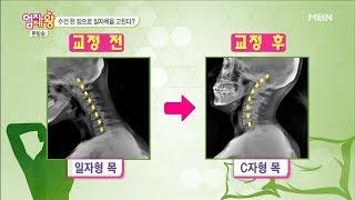 수건 한 장으로 '일자목' 고치는 방법! [엄지의 제왕 151회]