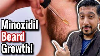 Minoxidil for Beard Growth | Does Minoxidil REALLY Help Beard Growth?