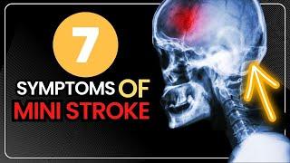 7 Symptoms of Mini Stroke - Transient Ischemic Attack ( TIA ) Signs