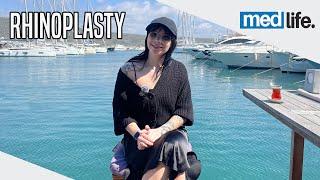 Irina's Medical Journey in Turkey | Rhinoplasty Surgery