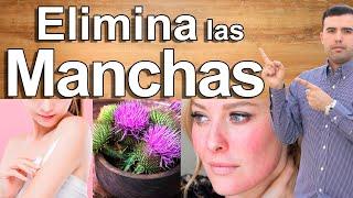 COMO ELIMINAR MANCHAS EN LA PIEL - Adiós a Las Manchas Para Siempre y Como Aclarar la Piel en Casa