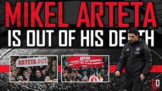 Mikel Arteta Is Out Of His Depth! #ArtetaOUT | Gunners Daily 