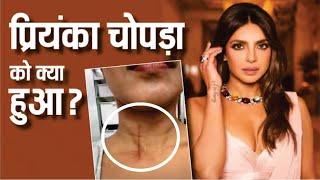 Priyanka Chopra injured during the bluff stunt shooting | शूटिंग के दौरान घायल हुईं Priyanka Chopra