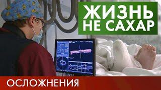 Осложнения диабета | Жизнь не сахар #14 (2019)