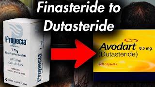 Switching from Finasteride to Dutasteride: Timestamps in Description