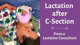 Lactation and breastfeeding After C Section: Breastfeed successfully, what you need to know